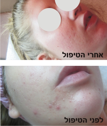 שרה חסון- כשקוסמטיקה פוגשת את הרוח