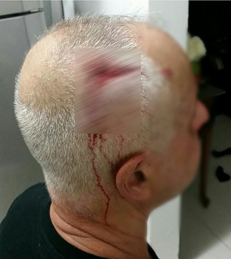 צעיר ערבי תקף את מארחו היהודי