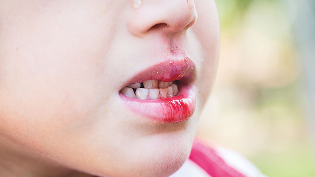 חשיפה ארצית: השיניים של הילדים  שלכם כבר לא מבוטחות בבית הספר