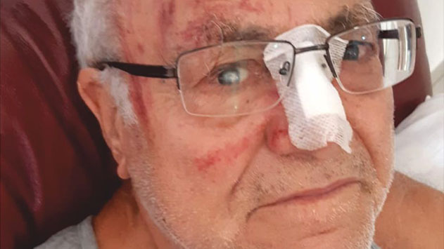 נס: קשיש בן 83 מאילת החליק לתעלה ברובע שש ושרד