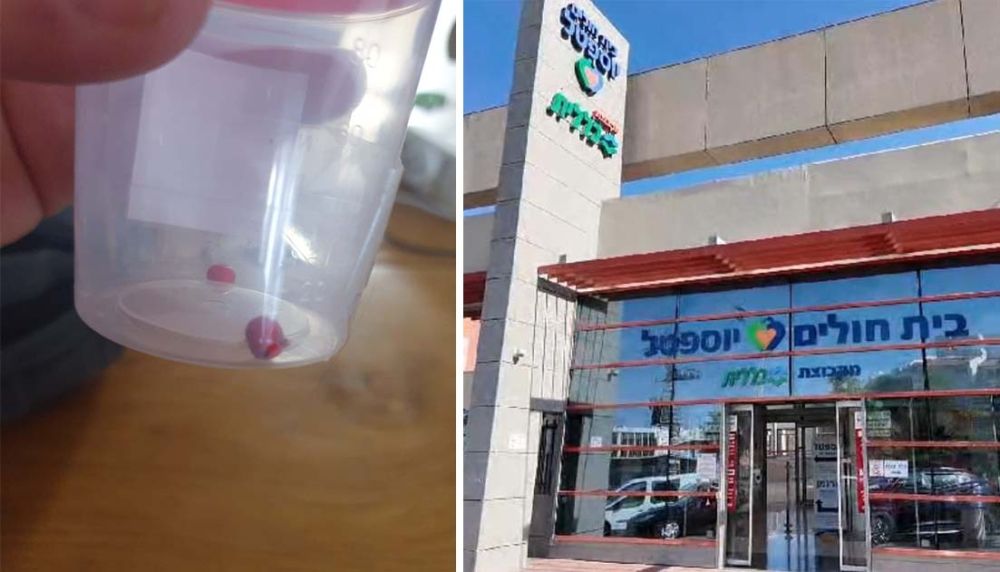 הצמיד נקרע, המשחק התמים של  בת ה-4 וחצי הסתיים בחדר ניתוח