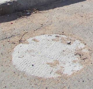 נפצעה בגלל רשלנות העירייה