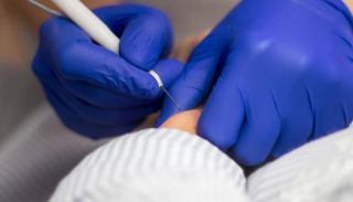 וירוס הפפילומה האנושי (HPV) - האם זה מסוכן?