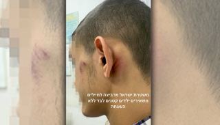 החשודה בהצתת דלת שכנה נעצרה בחשד להצתה נוספת