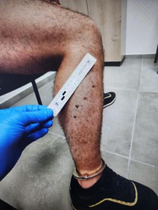 בגלל קופסת קוטג': כתב אישום נגד שני מעורבים באירוע תקיפת גבר בבית אורן